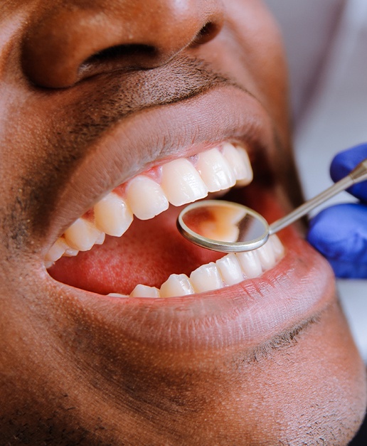 Dentist examining smile after treatment with bioactive materials