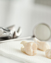 Several extracted teeth on gauze next to dental mirror and forceps