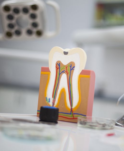 Model showing inside of a tooth before root canal therapy